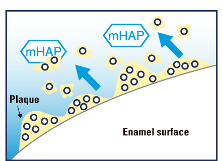 illustration of mhap removing plaque